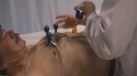 Imagem de Enfarte do Mioc�rdio