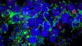 Imagem de Microbioma, Uma Arma Milagrosa