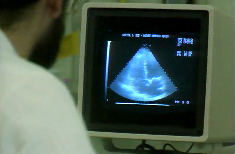 Aplicação da Lobotomia