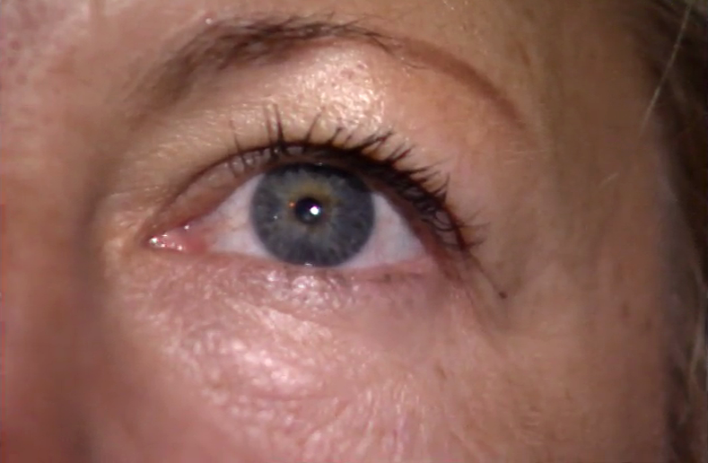 Viver Com Saúde – Episódio 03