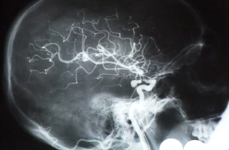 Viver com Saúde – Episódio 12