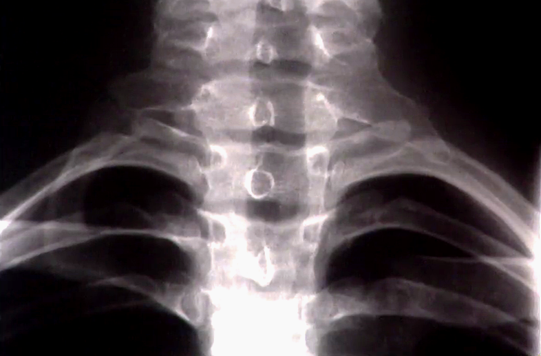 Viver com Saúde – Episódio 16