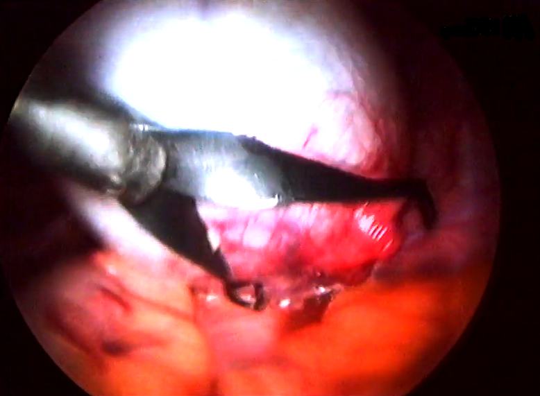 Viver com Saúde – Episódio 20