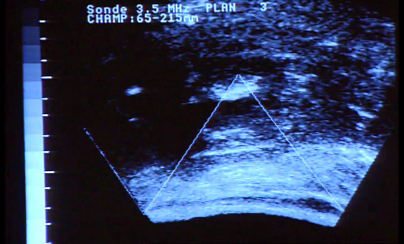 Viver com Saúde – Episódio 25