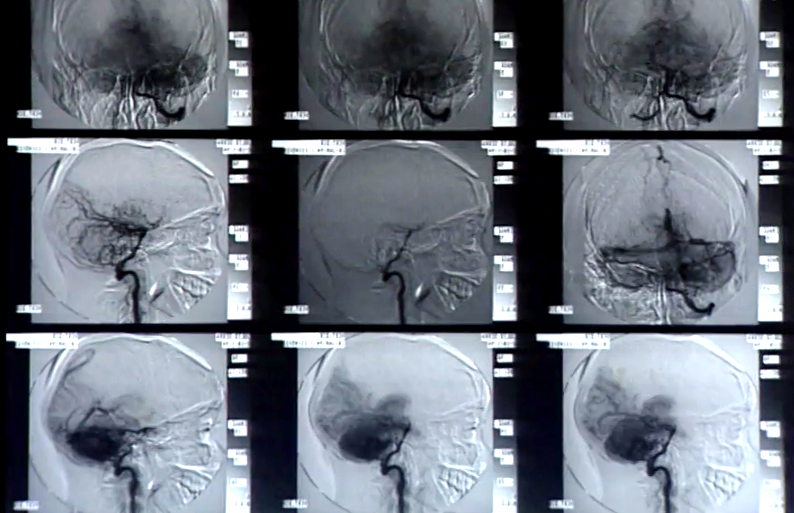 Viver com Saúde – Episódio 26