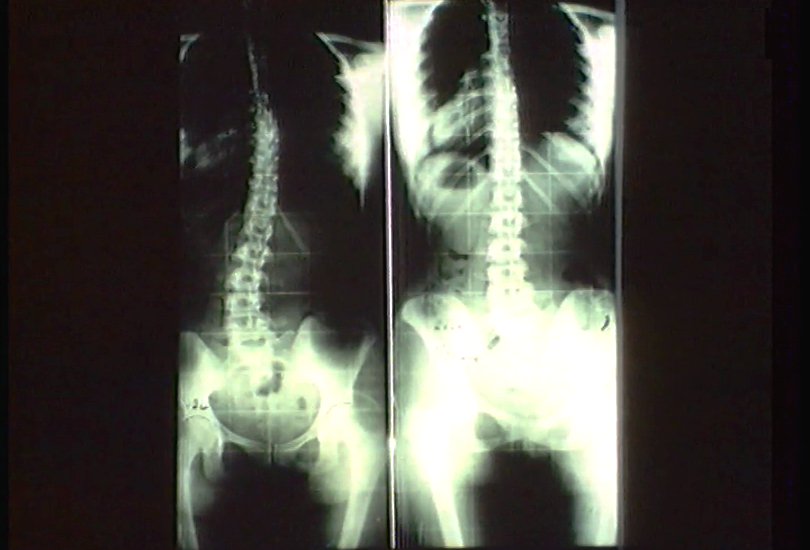 Viver com Saúde – Episódio 31