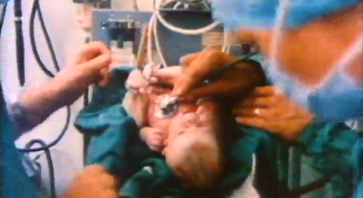 1978 – Bebé-proveta