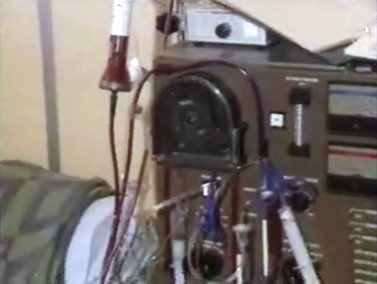 Dificuldades dos doentes insuficientes renais