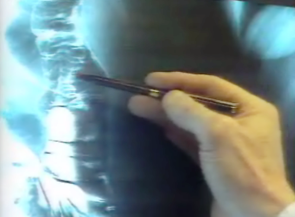 Reportagem sobre o cancro