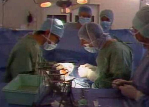 Transplante de órgãos e tecidos humanos