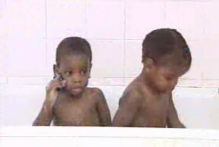 Gémeos siameses moçambicanos regressam ao seu país