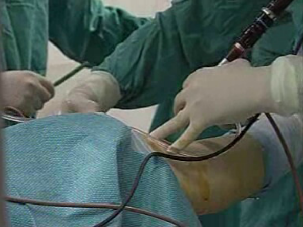 Cirurgia Artroscópica