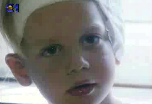 Implante contra a surdez