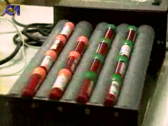 Transplante de tecidos fetais