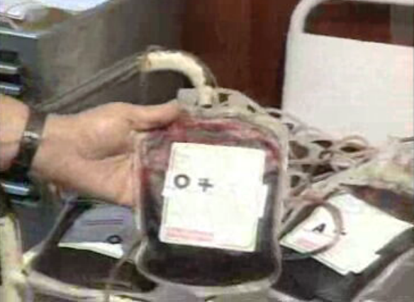 Caso dos hemofílicos contaminados