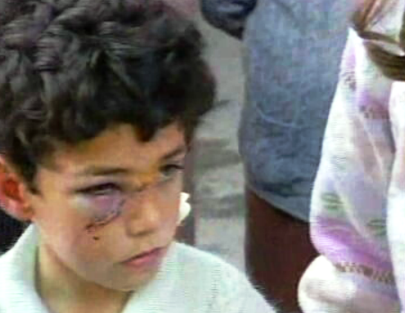 Crianças feridas no acidente ferroviário