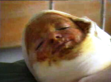 Acidentes com crianças