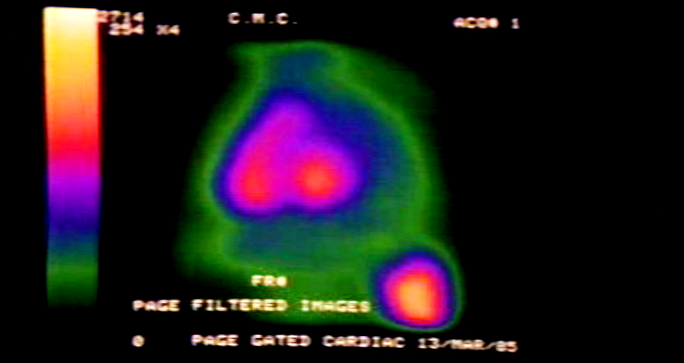 Coração Radioactivo, Coração Magnético