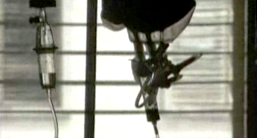 Transplante de medula óssea