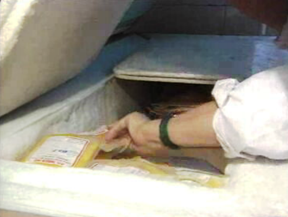 Caso dos hemofílicos