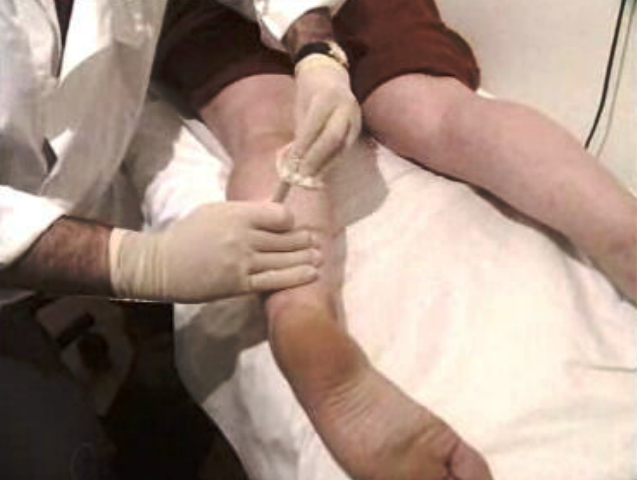 Portugueses sofrem de varizes