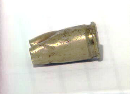 Desenvolvimentos no caso do jovem baleado no Pragal