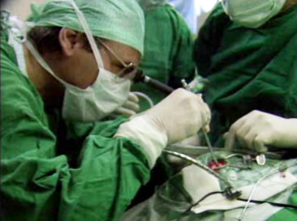 Cirurgia endoscópica cerebral