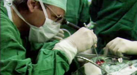 Cirurgia endoscópica cerebral