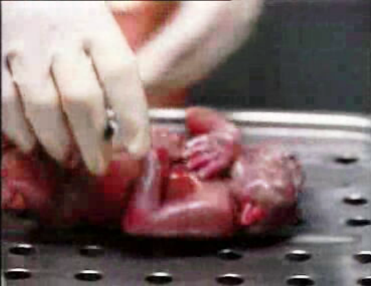 Reportagem sobre o aborto