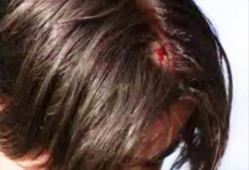 Estado clínico das vítimas de acidente de autocarro