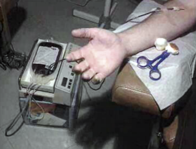 Hospitais do Norte não carecem de sangue e de dadores