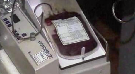 Falta de dadores de sangue