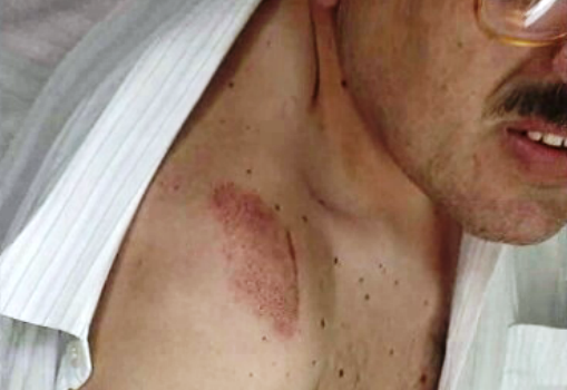 Balanço das vítimas do acidente no hipermercado