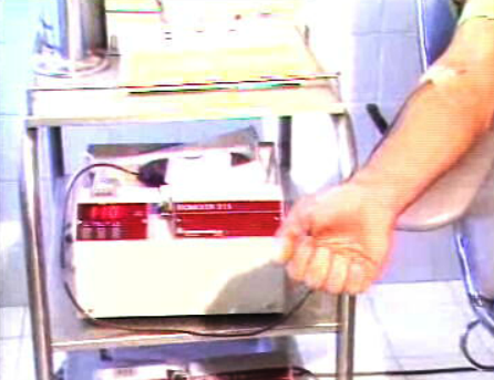 Caso dos hemofílicos