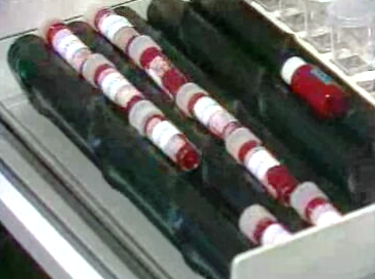 Caso dos hemofílicos