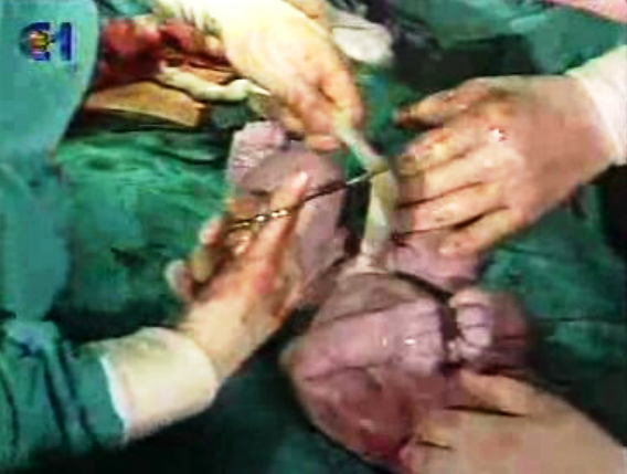 Falta de legislação