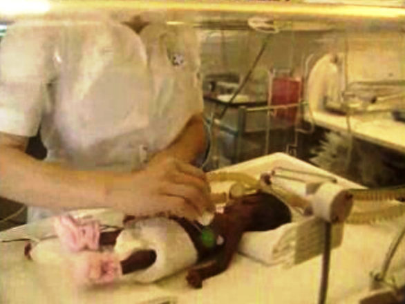 Bebés toxicodependentes