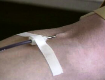 Processo de transfusão de sangue