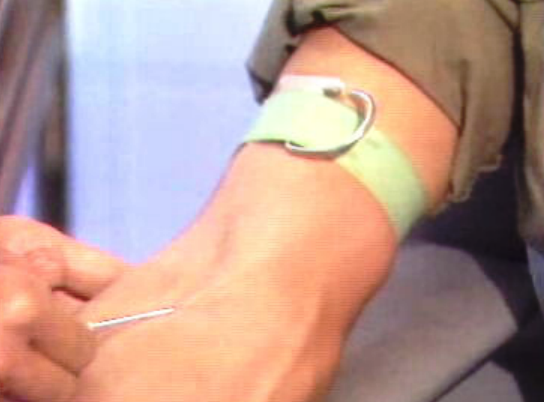 Caso dos hemofílicos