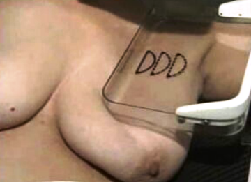 Consumo de azeite e cancro da mama