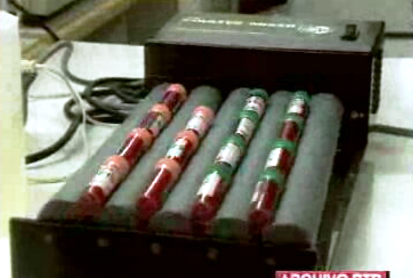 Caso dos hemofílicos com Sida