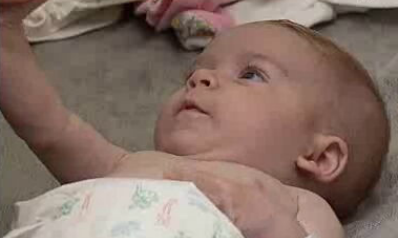 Fibrose Quística – Parte I