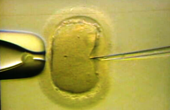 Campanha Nacional para dadores de gâmetas