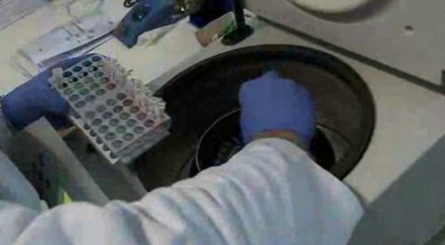 Cirurgias preventivas