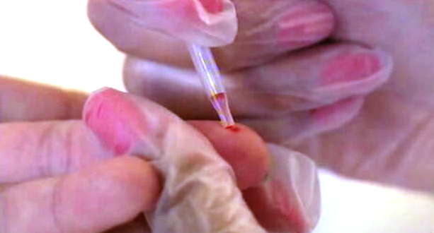 Rastreios ao vírus HIV e às hepatites B e C