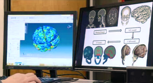 Simulador de lesões cerebrais