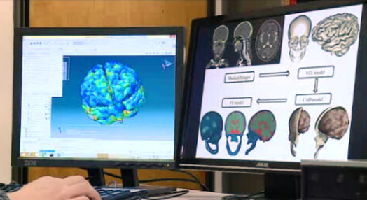 Simulador de lesões cerebrais
