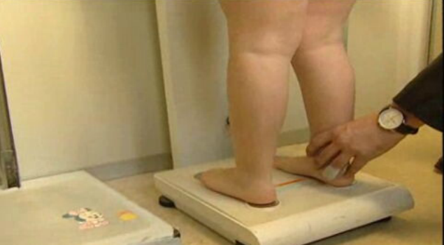 Dia Europeu da Obesidade