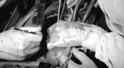 A Cardiologia em Portugal