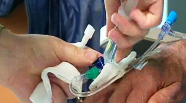 Listas de espera para oncologia